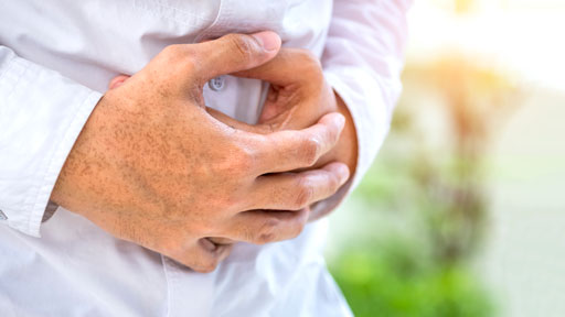 About Crohn's Disease | NHGRI