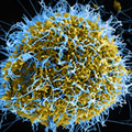 Ebola virus particles