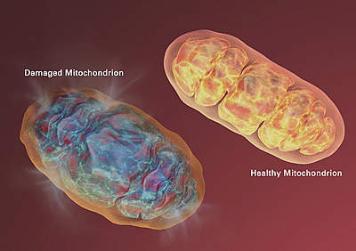 Two Mitochondrions compared. Damaged on the left, healthy on the right.