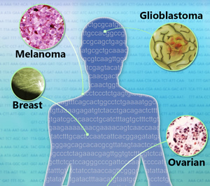 Different types of cancer illustrated on a human figure