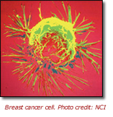 Breast Cancer Cell Photo courtesy of NCI