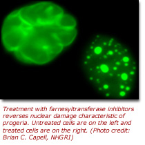 Photo image of how treatment with farnesyltransferase inhibitors reverses nuclear damage characteristic of progeria. Untreated cells are on the left and treated cells are on the right. (Photo credit: Brian C. Capell, NHGRI)