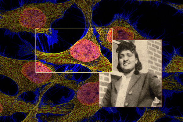 Henrietta Lacks and HeLa Cells