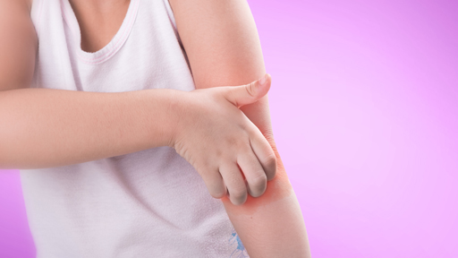 Study of Skin Microflora in Children with Atopic Dermatitis | NHGRI
