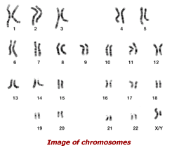 Image of chromsomes