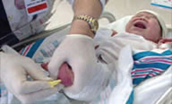 A health professional collecting blood from a newborn by using a heel stick. Photo courtesy of CDC website and Dr. Brad Therrell at http://www.cdc.gov/nbslabbulletin/bulletin.html