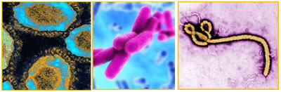SARS, Klebsiella, Ebola viruses