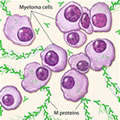 Myeloma cells