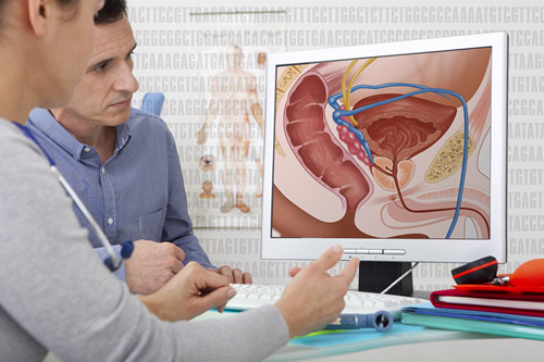 A health professional and a patient looking at a computer screen where prostate is illustrated
