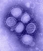 H1N1 Flu virus. Photo courtesy of CDC.