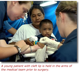 Young patient with cleft lip in the arms of medical team prior to repair surgery.