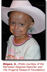Photo of Megan, 5, a progeria patient. (Photo courtesy of The Progeria Research Foundation)
