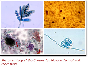 Photo Courtesy of the Centers of Disease Control