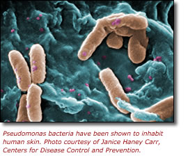 Pseudomonas bacteria have been shown to inhabit human skin. Photo courtesy of Janice Haney Carr, Centers for Disease Control and Prevention.