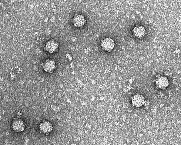 Electron micrograph of Phi X 174