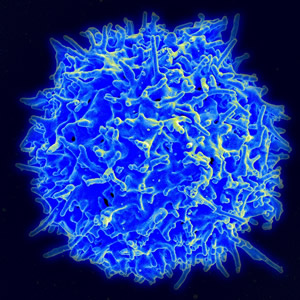 Scanning electron micrograph of a human T lymphocyte (also called a T cell) from the immune system of a healthy donor. Source: National Institute of Allergy and Infectious Diseases (NIAID)