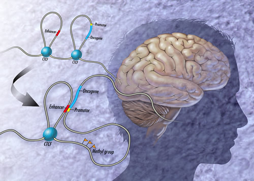 An illustration of brain cancer loops