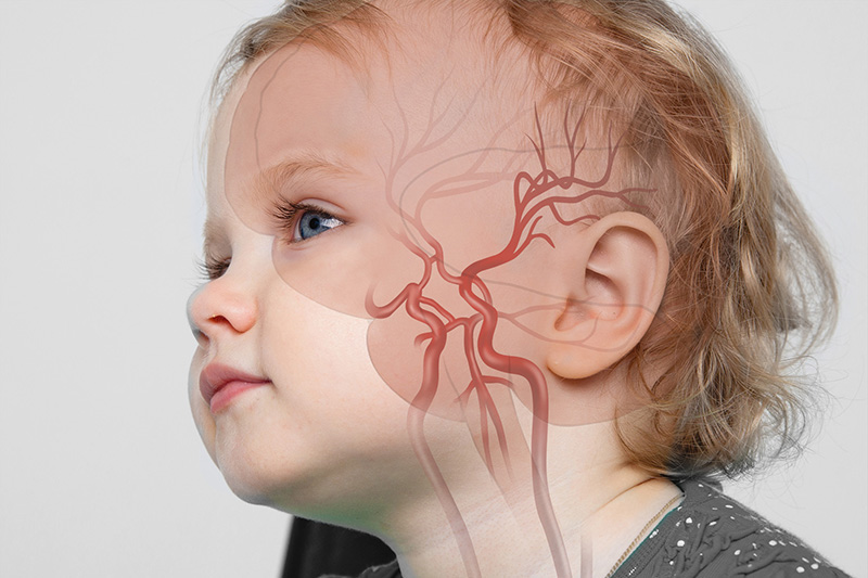 Child with stroke