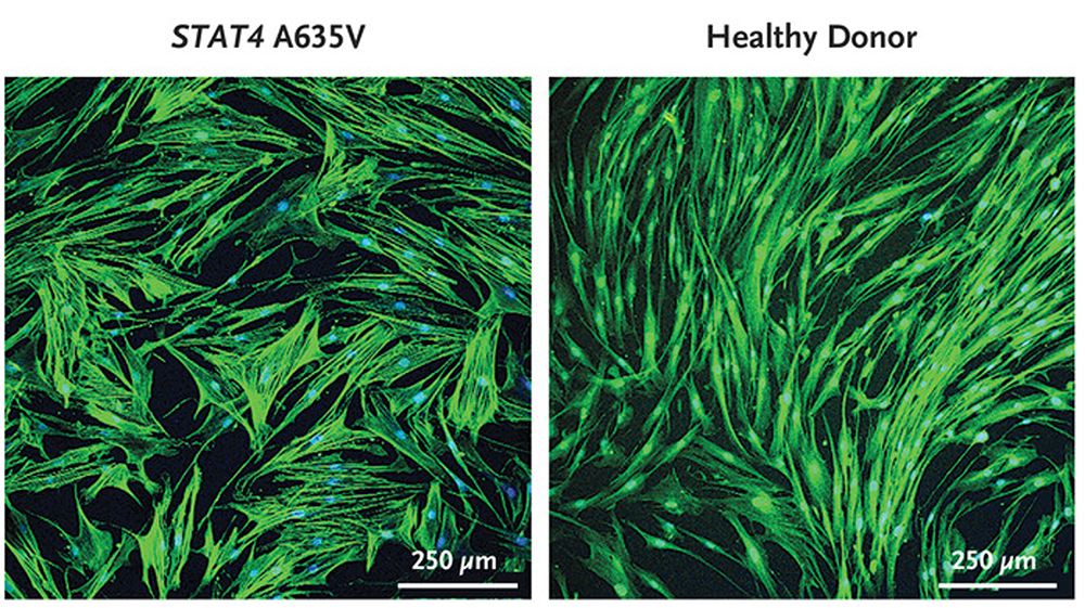 Comparison of fibroblast cells