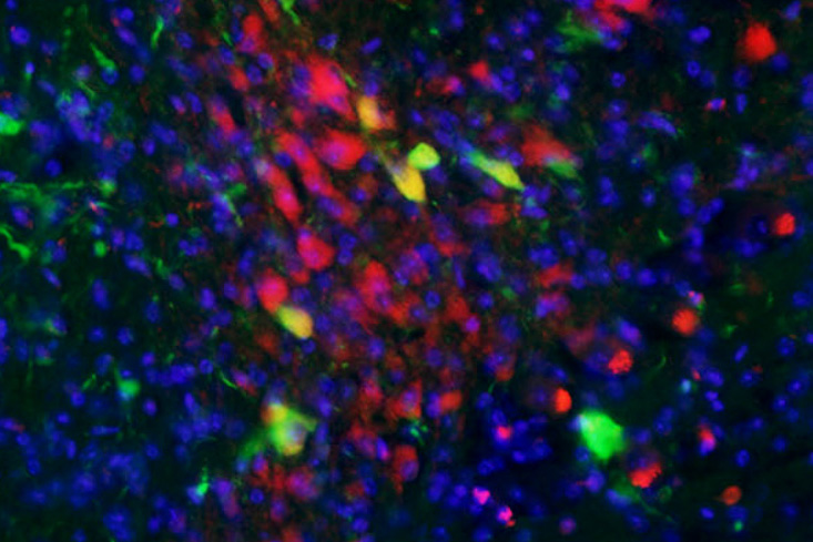 Midbrain neurons from the new mouse model. 