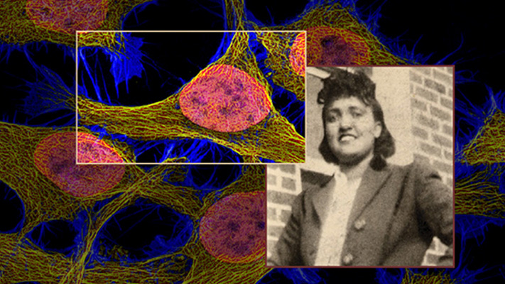Henrietta Lacks with HeLa cells in the background