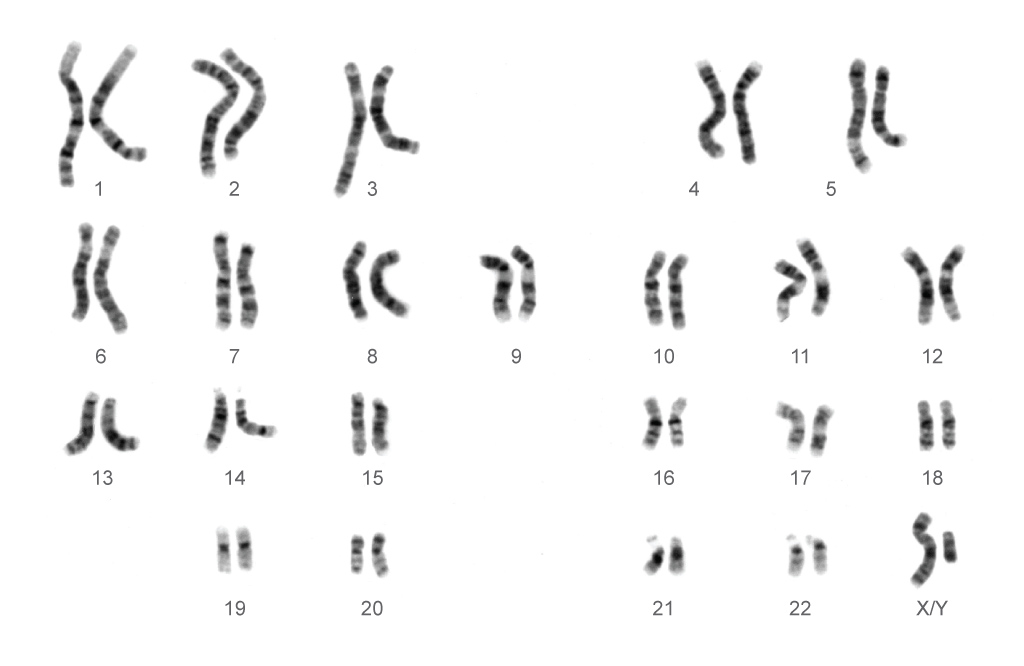 Human chromosomes