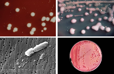 clinical microbial genomics microscope view