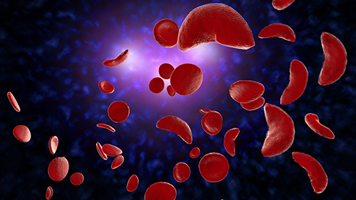 Sickle cell anemia disease (SCD) blood cells 3D illustration