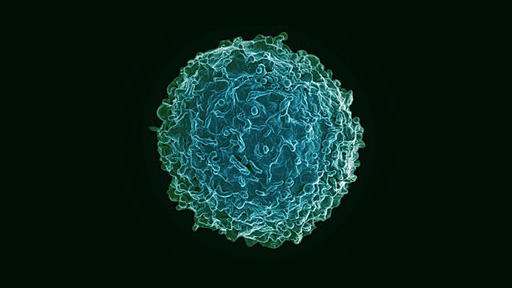 Lupus b cells