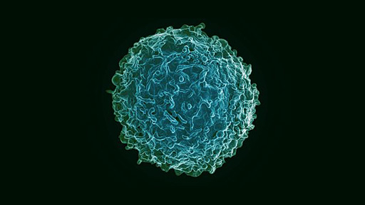 Lupus b cells