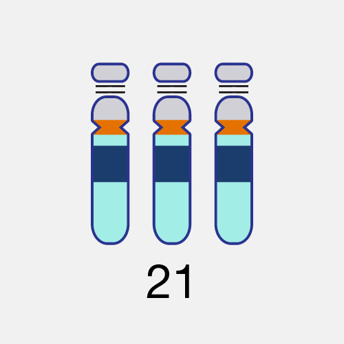 Síndrome de Down (Trisomía 21)