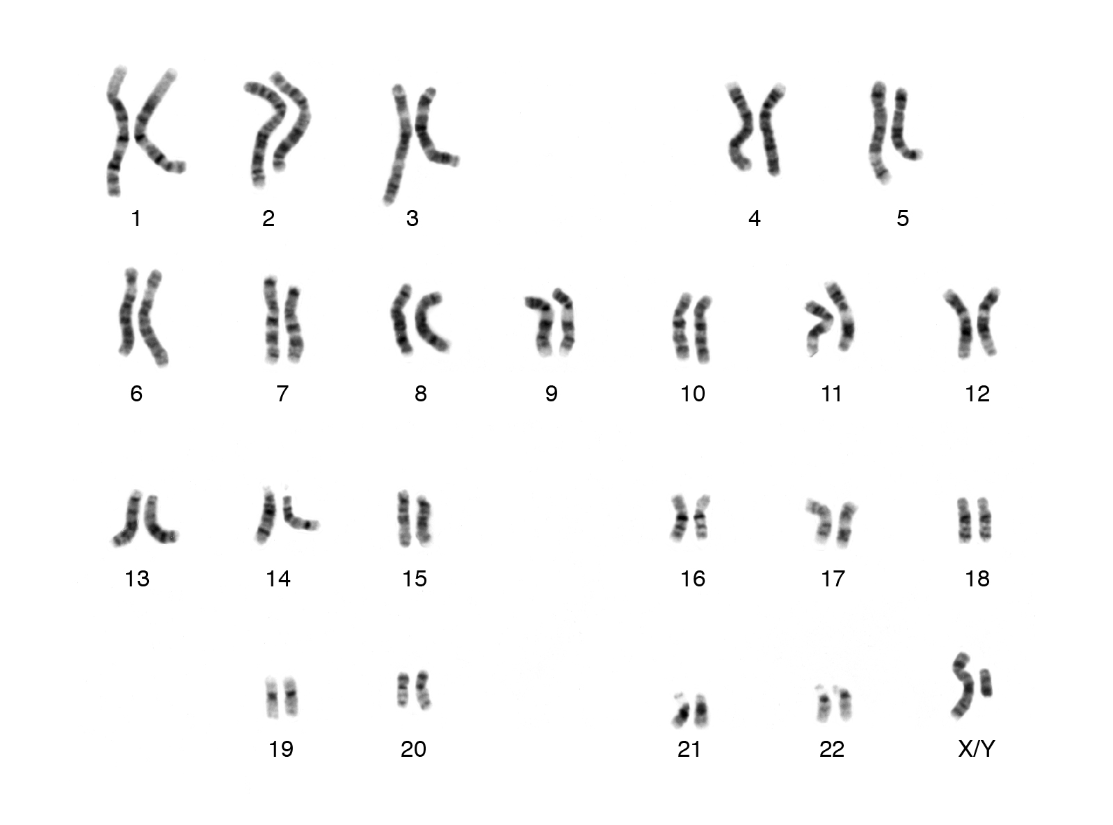 Human Chromosome Pairs