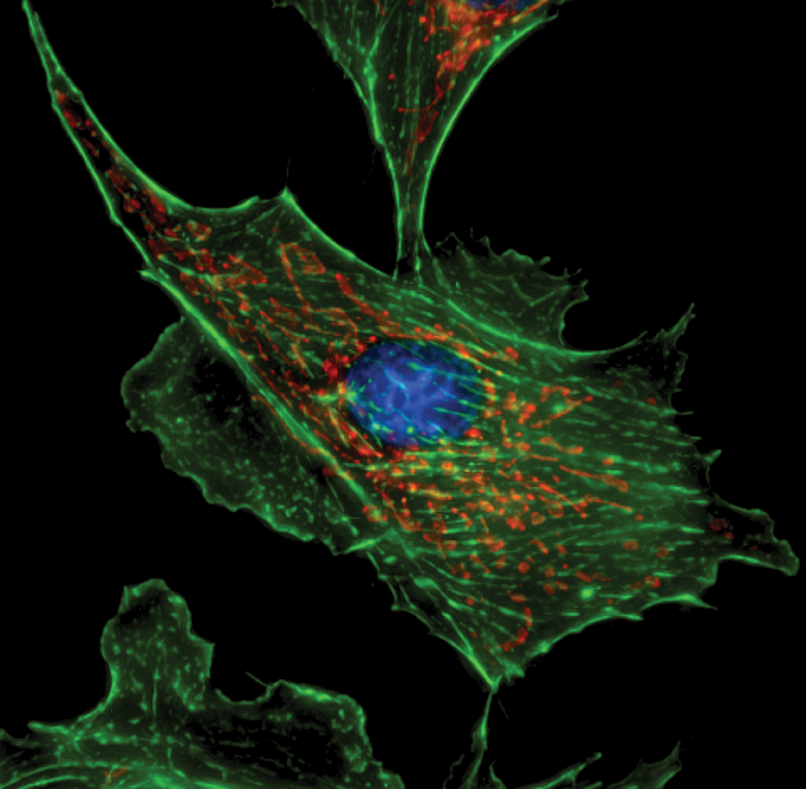Fibroblasto